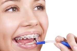Girl cleaning braces