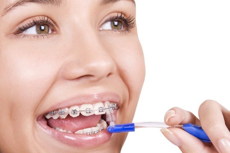 Girl cleaning braces