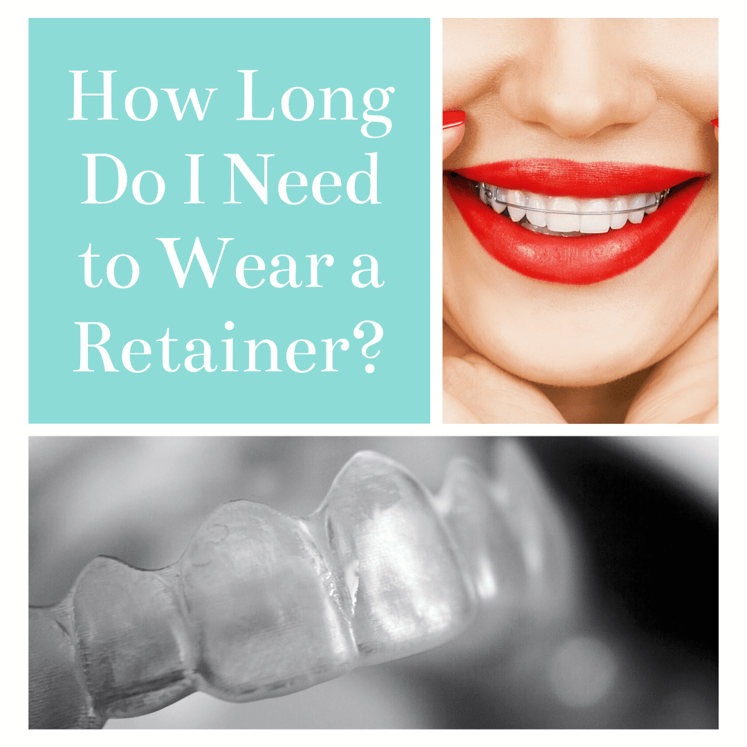 retainer