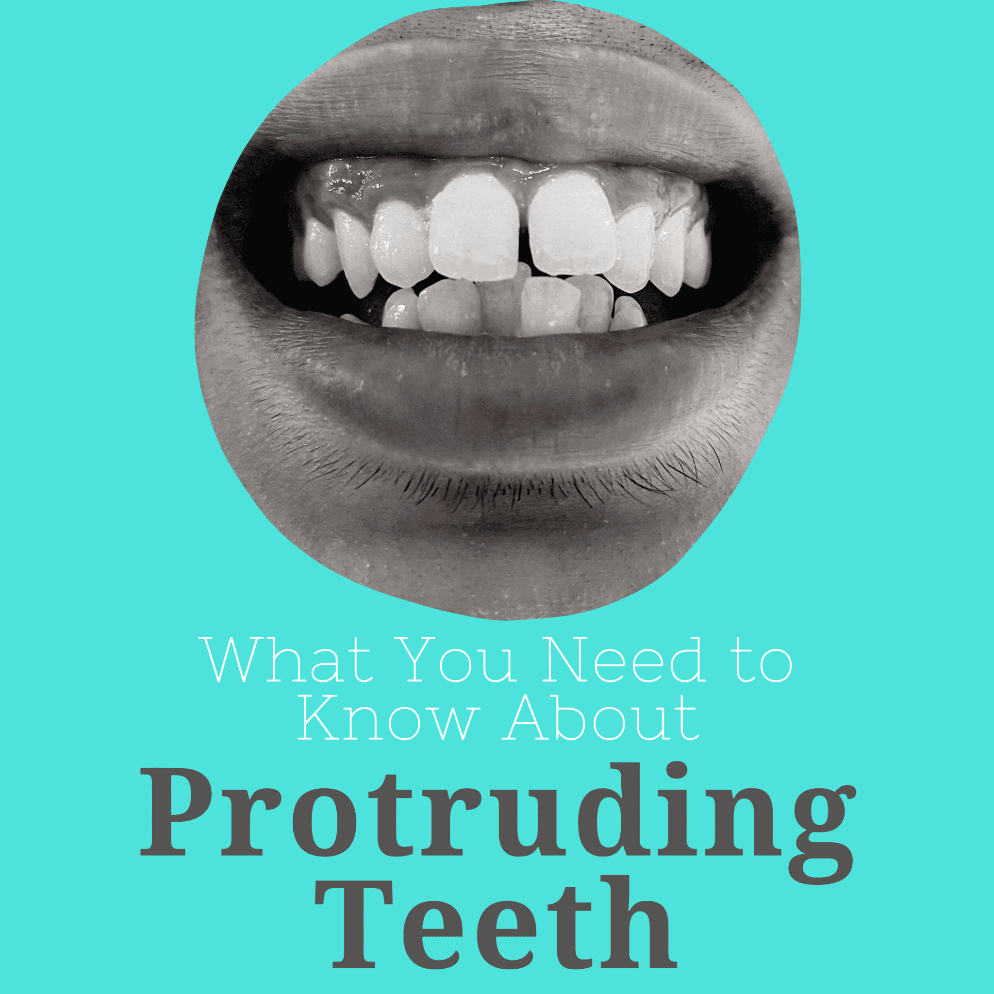 what-you-need-to-know-about-protruding-teeth