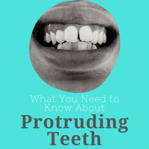 What You Need to Know About Protruding Teeth