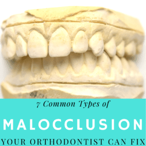 7 Common types of malocclusion (1)