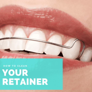 How to clean your retainer