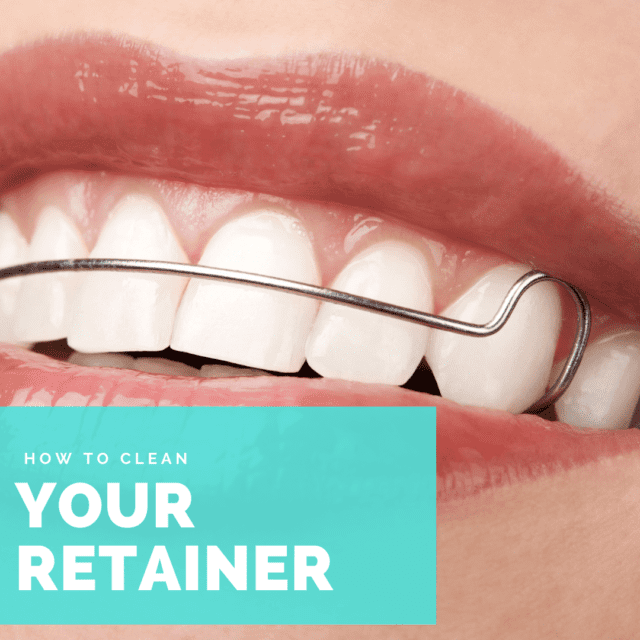 How to Clean Your Retainer