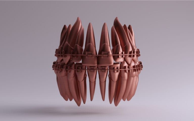 Copper Dentures