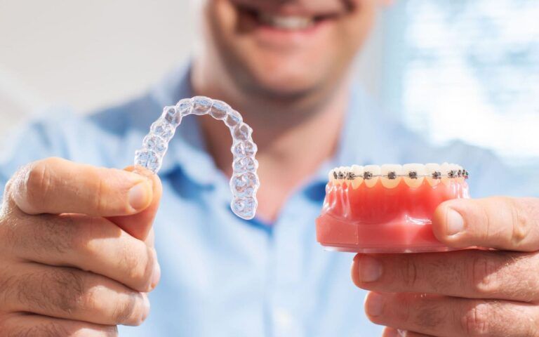 Man Holding Aligners and Tooth Model